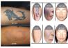 Лазер YAG за премахване на татуировки,петна лунучки | Оборудване  - Пловдив - image 2